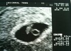 IMG 1005  First Ultrasound of little Maddy, looks like a magot