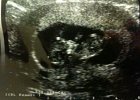 IMG 1030  Taken on the 21 March 2012, you can see her head, hands and feet.
