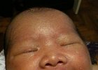 IMG 1263  Day 7 - little dimple started showing